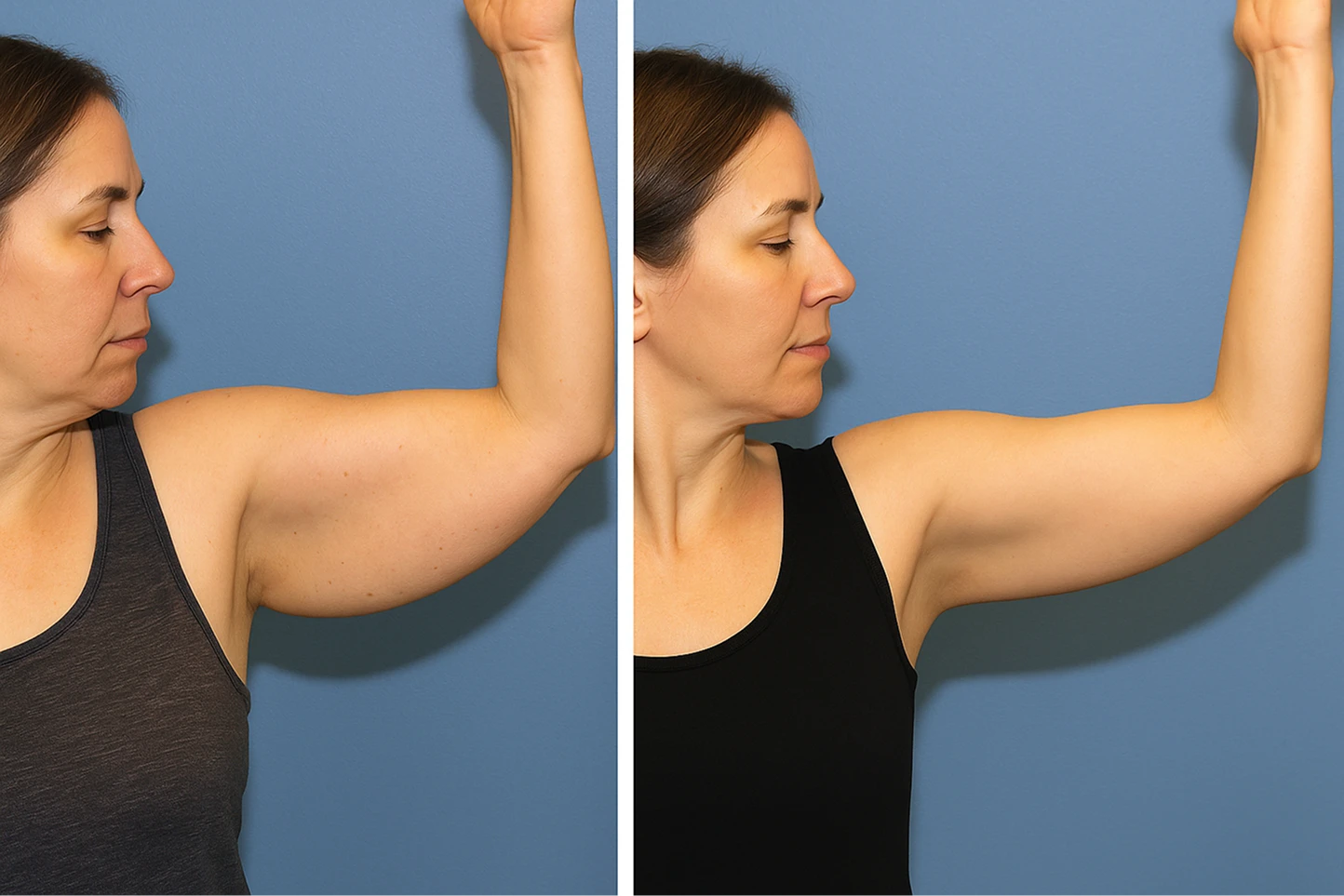 Resultados Antes e Depois